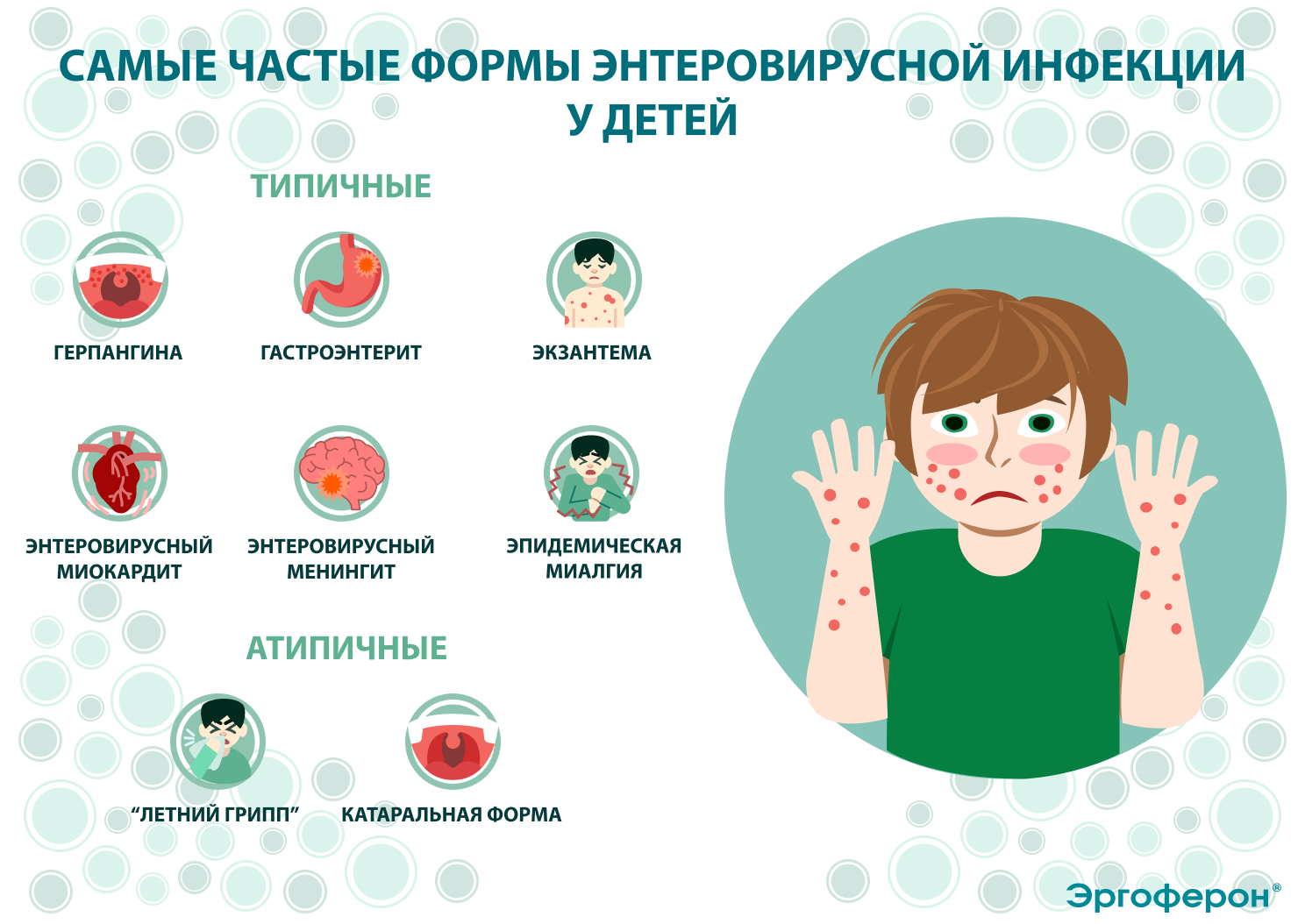 Симптомы энтеровируса у детей