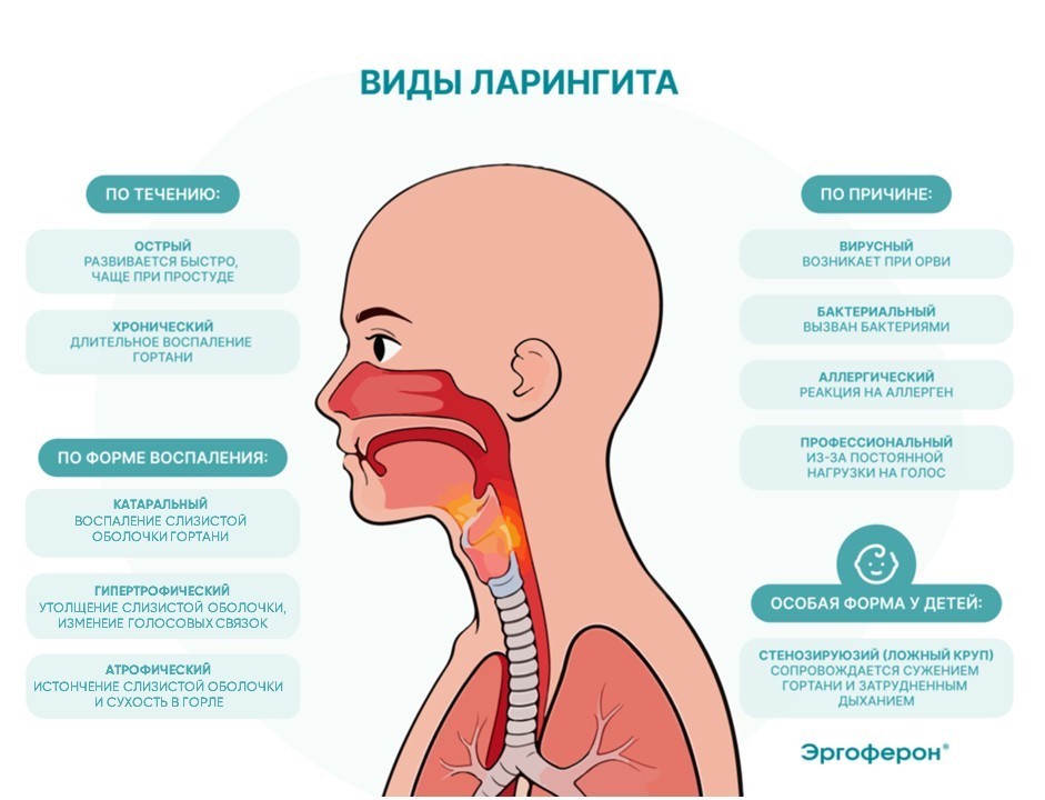 Виды ларингита.jpg