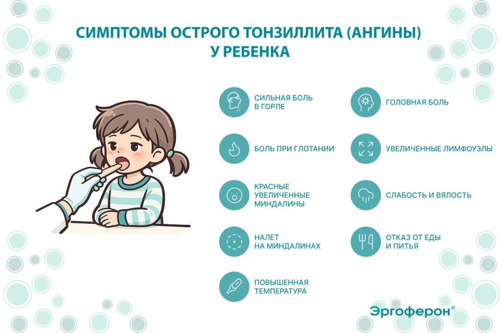 Эргоферон: Симптомы острого тонзиллита ангины у ребенка