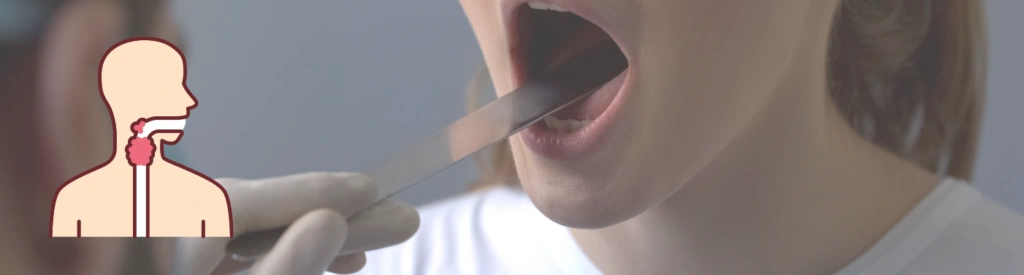 Симптомы и признаки гнойной ангины у взрослых